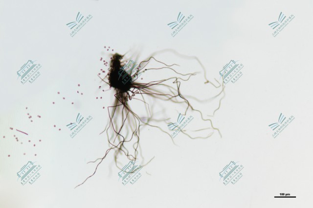4.毛壳属-球毛壳 Chaetomium globosum (2).jpg
