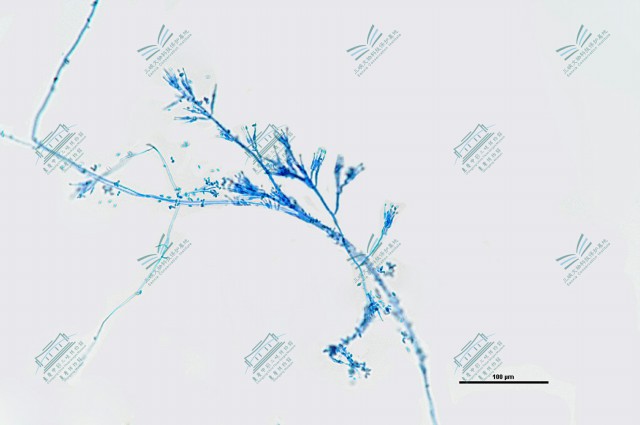 5.枝孢属-枝孢样枝孢霉 Cladosporium cladosporioides (2).jpg